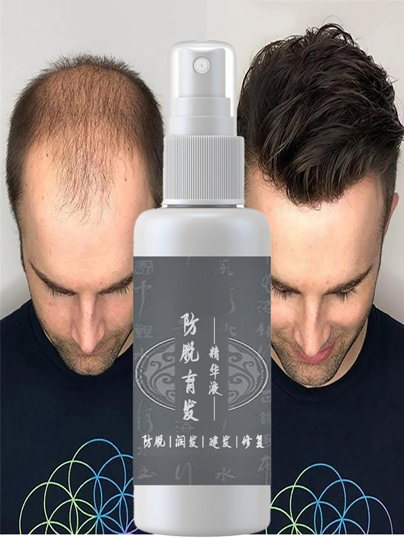 Nutrition And Fitness - Magic Hair Regrowth Spray Essence Soro