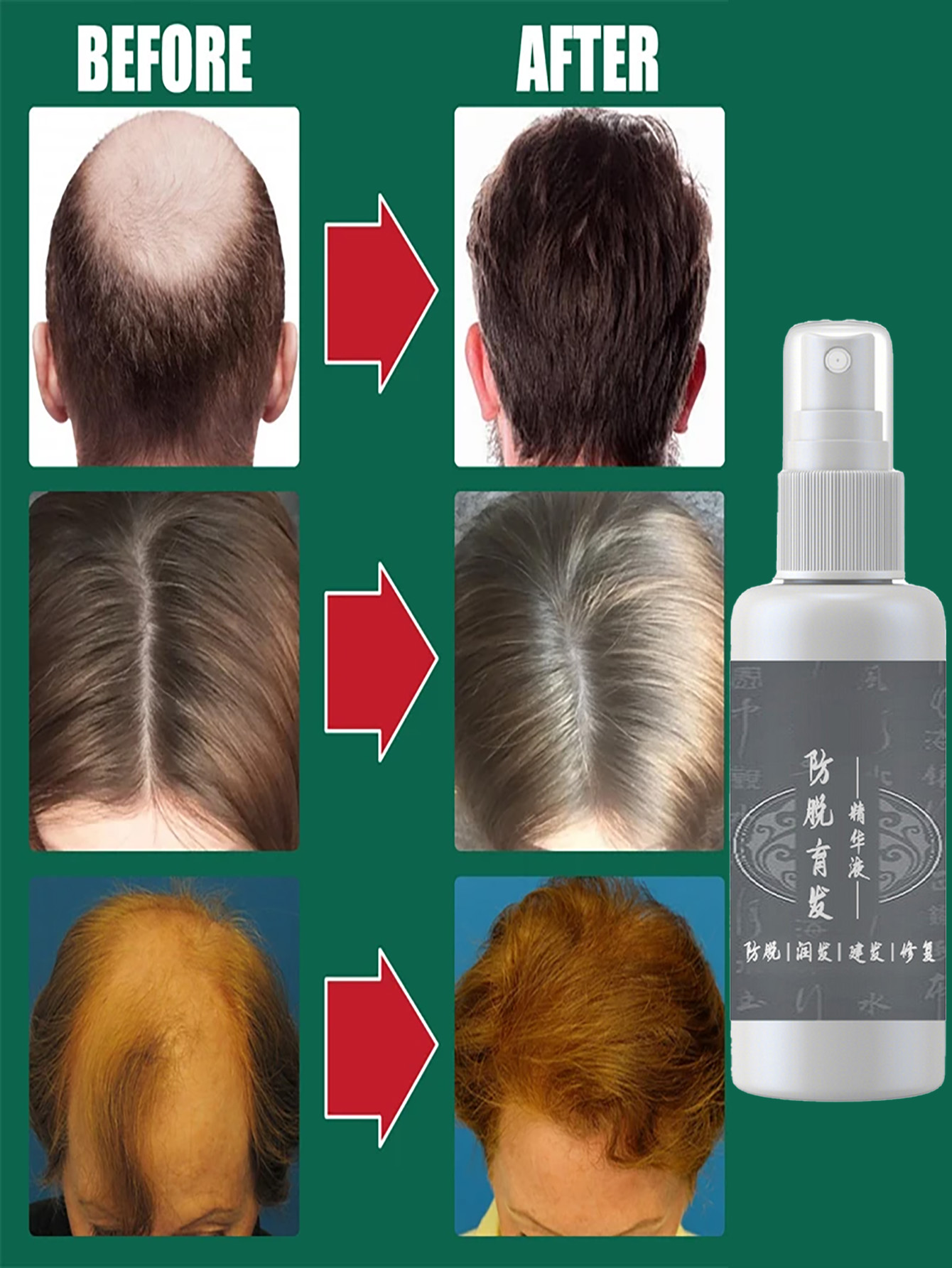 Magic Hair Regrowth Spray Esse - Nutrition And Fitness avaliação e preço
